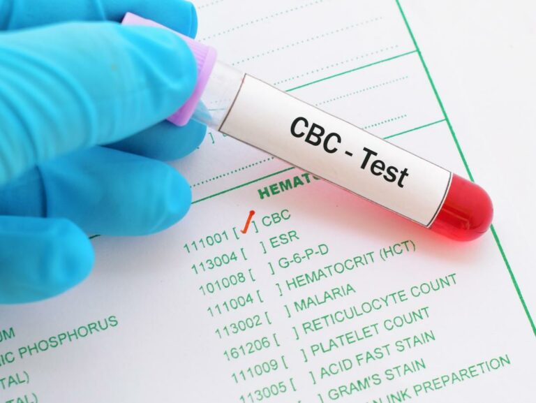 cbc-blood-test-preparation-and-procedure-gethow